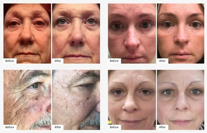 Neora Age IQ - Night Cream with Bidens Pilosa, Peptides & Hyaluronic Acid - Smooths Skin, Boosts Radiance, Fights Wrinkles, Firms - 1 fl.oz.