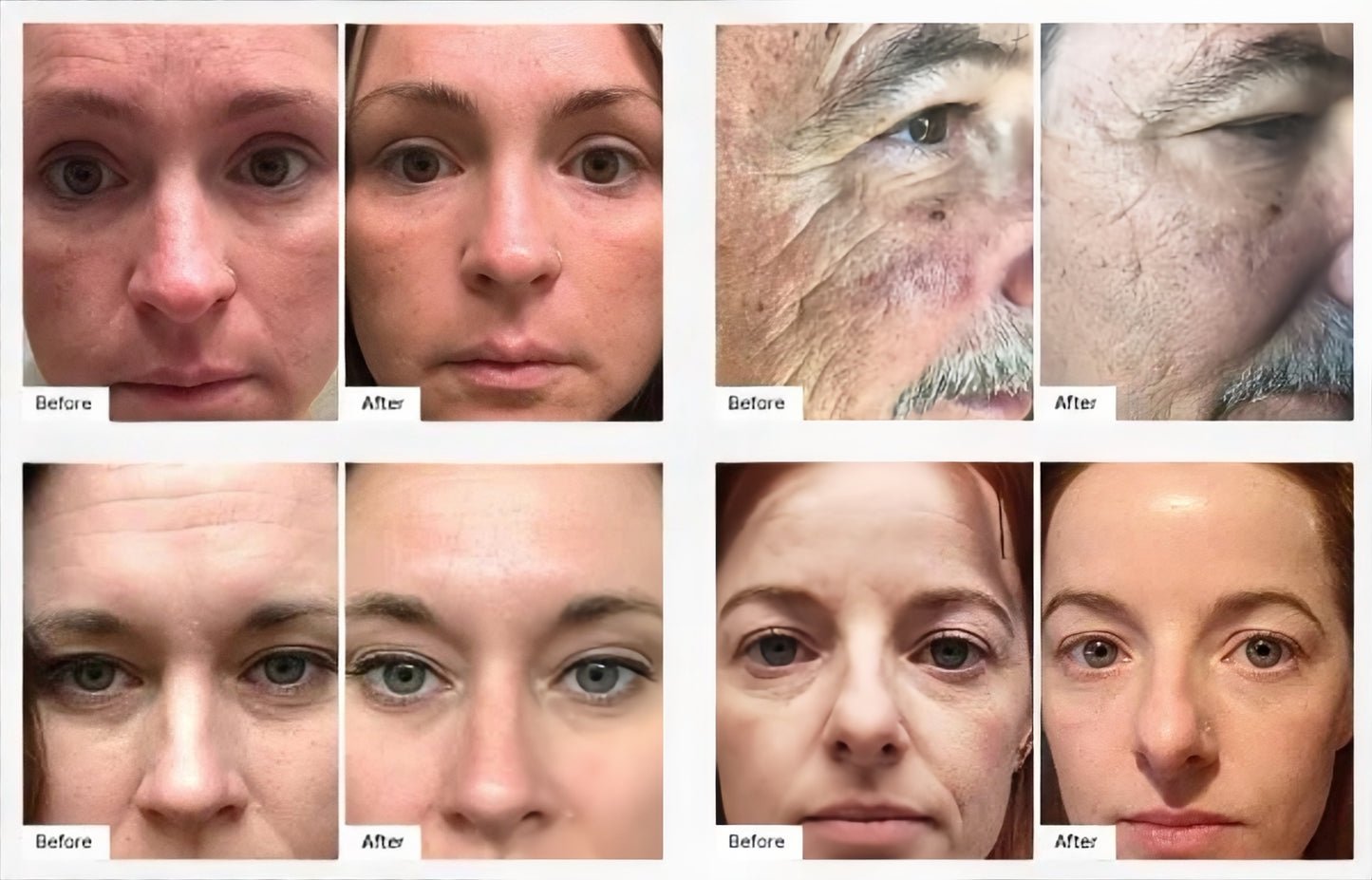 Age IQ® Night & Day Combo – Day & Night Anti-Aging Skincare Set with Bidens Pilosa, Peptides & Hyaluronic Acid – Smooths Fine Lines, Boosts Radiance, Firms & Hydrates – 1 fl. oz. Each